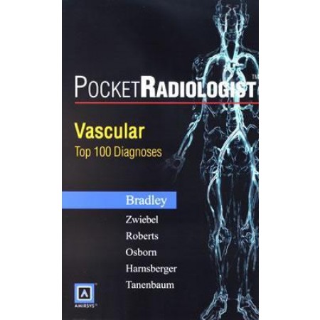 PocketRadiologist: Vascular Top 100 Diagnoses