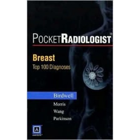PocketRadiologist: Breast 100 Top Diagnoses