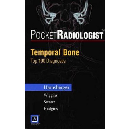 PocketRadiologist - Temporal Bone: Top 100 Diagnoses