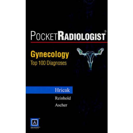 PocketRadiologist: Gynecologic Top 100 Diagnoses