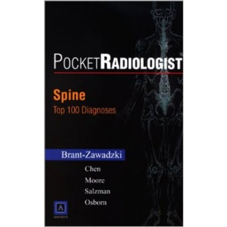 PocketRadiologist - Spine: Top 100 Diagnoses