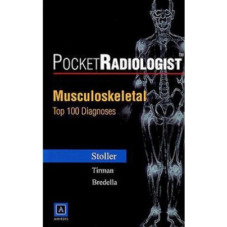 PocketRadiologist: Musculoskeletal Top 100 Diagnoses