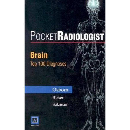 PocketRadiologist: Brain Top 100 Diagnoses