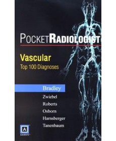 PocketRadiologist: Vascular Top 100 Diagnoses