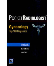 PocketRadiologist: Gynecologic Top 100 Diagnoses