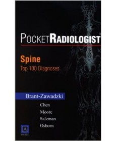 PocketRadiologist - Spine: Top 100 Diagnoses