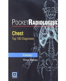 PocketRadiologist: Chest Top 100 Diagnosis