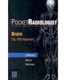 PocketRadiologist: Brain Top 100 Diagnoses