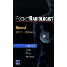 PocketRadiologist: Breast 100 Top Diagnoses