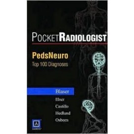 PocketRadiologist - PedsNeuro: Top 100 Diagnoses