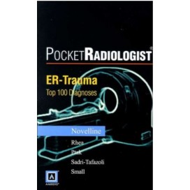 PocketRadiologist: ER Trauma Top 100 Diagnoses