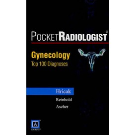 PocketRadiologist: Gynecologic Top 100 Diagnoses