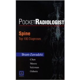 PocketRadiologist - Spine: Top 100 Diagnoses