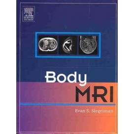 Body MRI