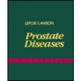 Prostate Diseases