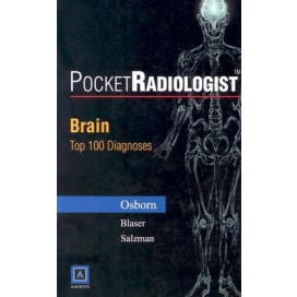 PocketRadiologist: Brain Top 100 Diagnoses